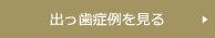 出っ歯（上顎前突）症例を見る