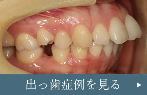 東京港区麻布の矯正歯科 Uc矯正歯科クリニック麻布十番 指導医